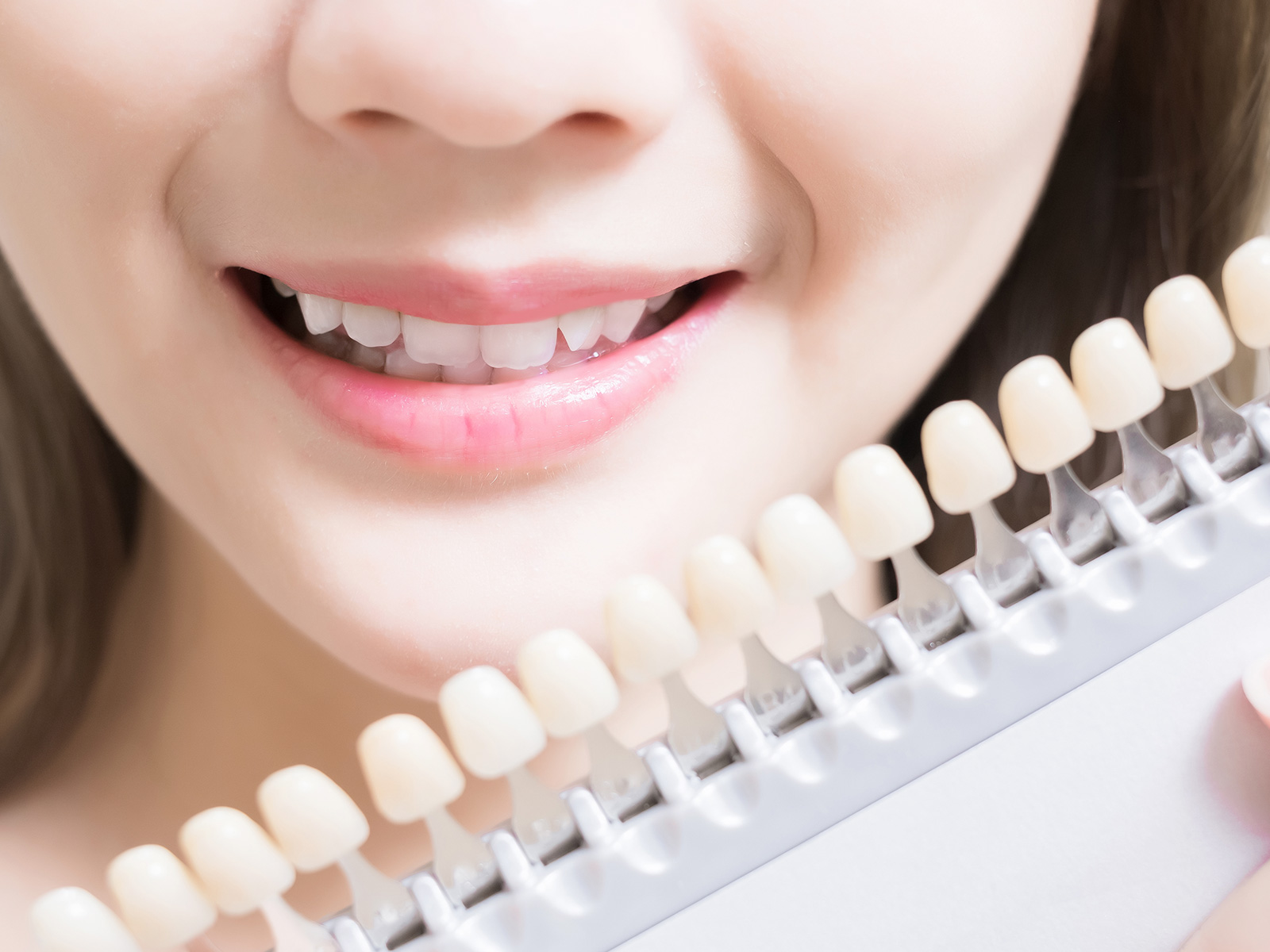 ホワイトニング